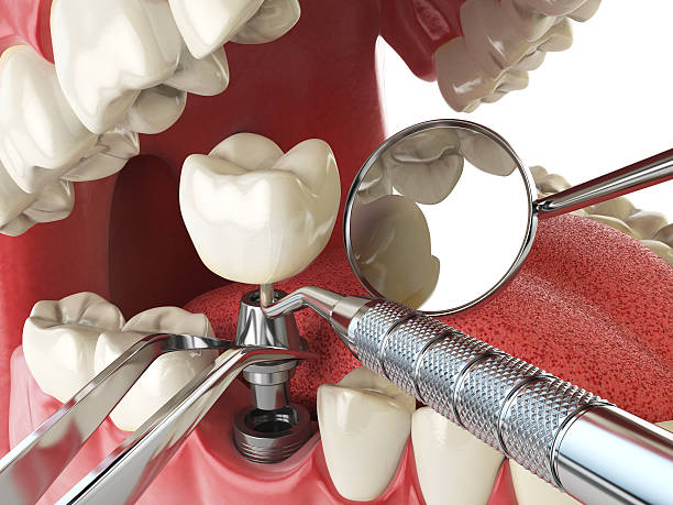 Best Weekend Emergency Dentist in Carpendale, WV